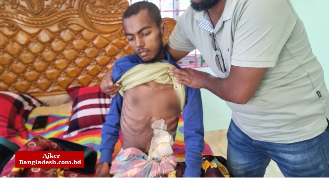 অর্থাভাবে বিনা চিকিৎসায় মৃত্যুর প্রহর গুনছে ওমান প্রবাসী নুরুল হুদা অর্থাভাবে বিনা চিকিৎসায় মৃত্যুর প্রহর গুনছে ওমান প্রবাসী নুরুল হুদা