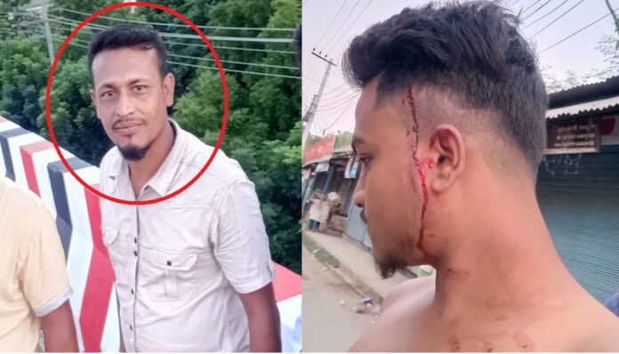 ঘরে ঢুকে টাকা চুরি! চিনে ফেলায় যুবককে রড দিয়ে পিটিয়ে জখম