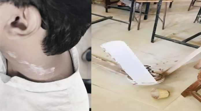 রুয়েটে শ্রেণিকক্ষে সিলিং ফ্যান পড়ে শিক্ষার্থী আহত
