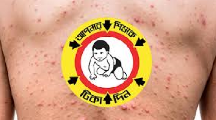 টিকাদান কর্মসূচিতে ধস: বাংলাদেশে হামের ভয়াবহ প্রাদুর্ভাব নিয়ে বিশ্ব স্বাস্থ্য সংস্থার সতর্কবার্তা