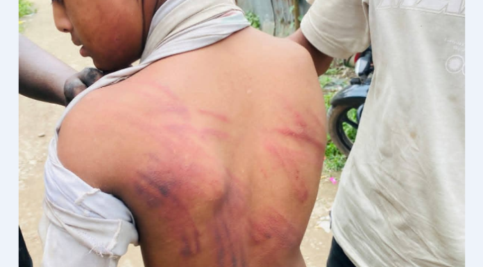 দুটি আমের জন্য শিশুকে অমানবিক নির্যাতন
