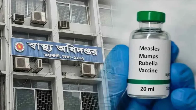হামের উপসর্গে আরও ৫ শিশুর মৃত্যু, আক্রান্ত ৭৯৬