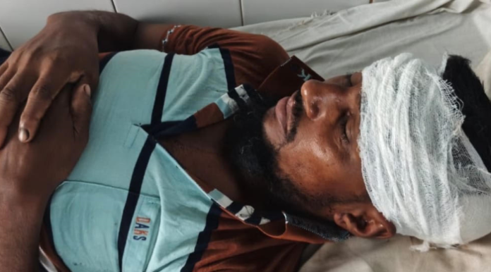 সাপাহারে তুচ্ছ ঘটনায় দম্পতি কে পিটিয়ে জখম