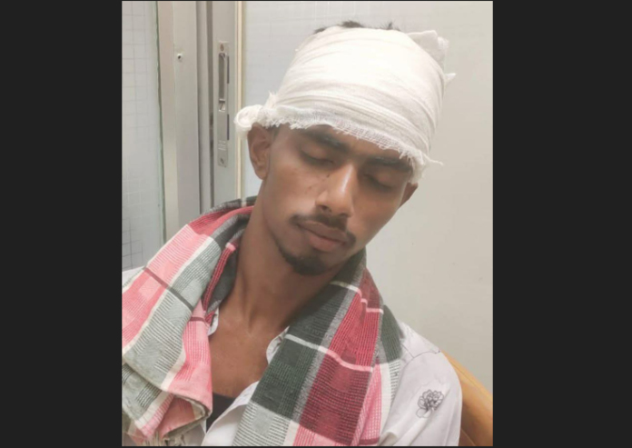 কেশবপুরে জামিনে থাকা ইয়াবা মামলার আসামির হাতুড়ির আঘাতে কারুশিল্পী মিস্ত্রি রক্তাক্ত