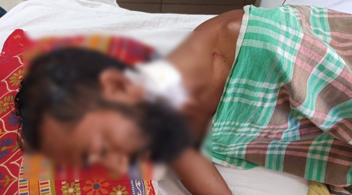 মামলায় সাক্ষী হওয়ায় মহিপুরে যুবককে কুপিয়ে জখম