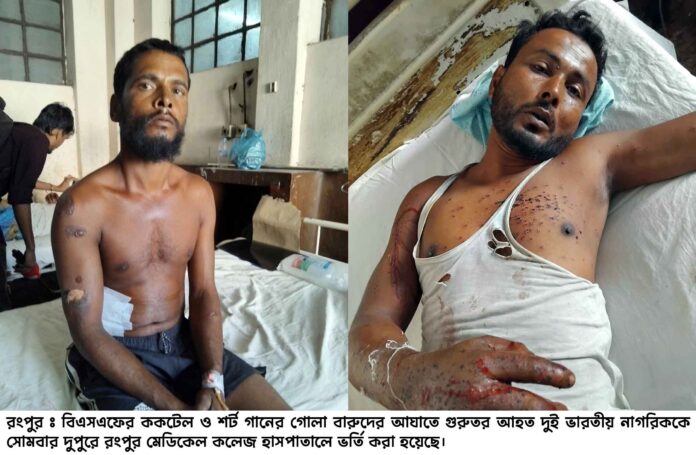 বিএসএফের ককটেল ও শর্ট গানের গুলিতে আহত দুই ভারতীয় নাগরিক রমেক হাসপাতালে ভর্তি